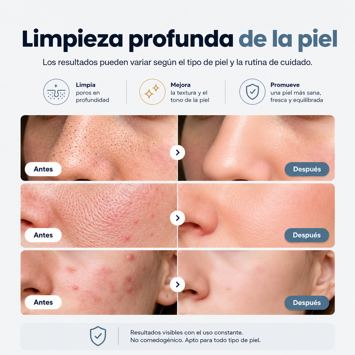 Peeling Ultrasónico de Limpieza Profunda